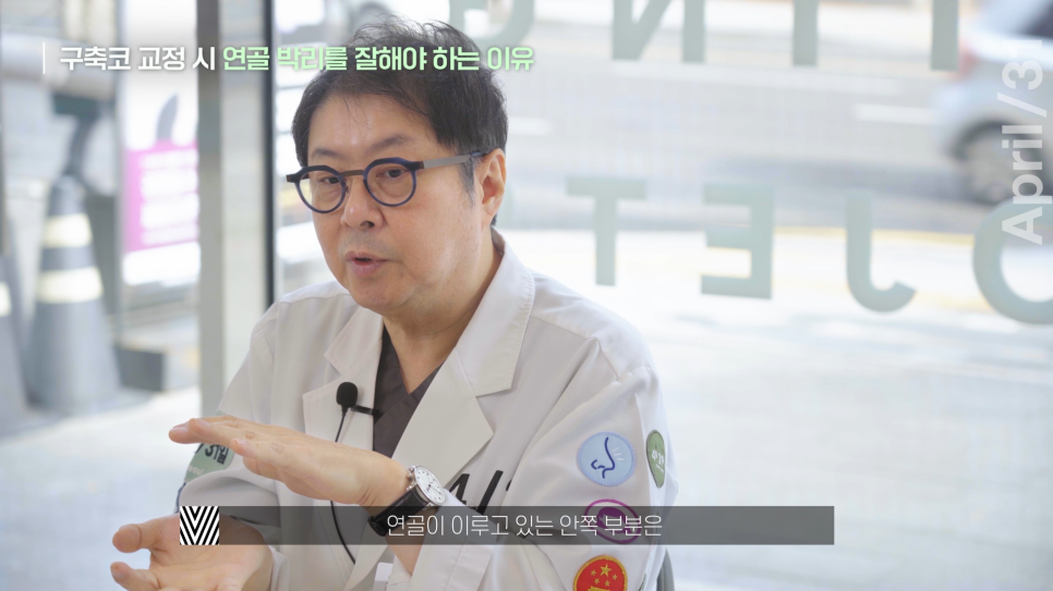 [Contracted Nose] Deep Analysis of the 5 Steps of Contracted Nose Correction Part 02_Separation of the Cartilage Structure and Relocation to the Correct Position image 7