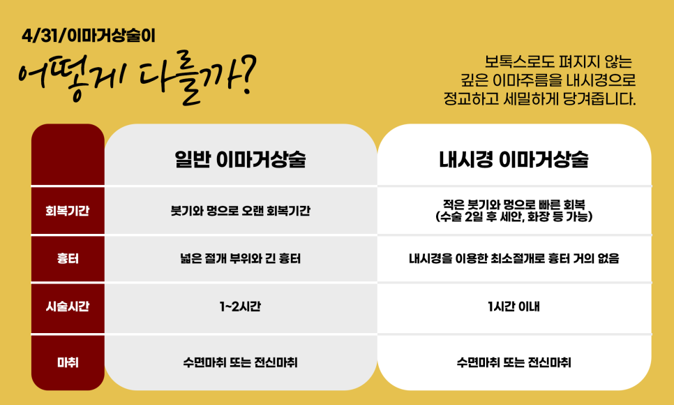 내시경이마거상술잘하는곳 에서 받고 다시 젊은 모습으로 관련 이미지 5