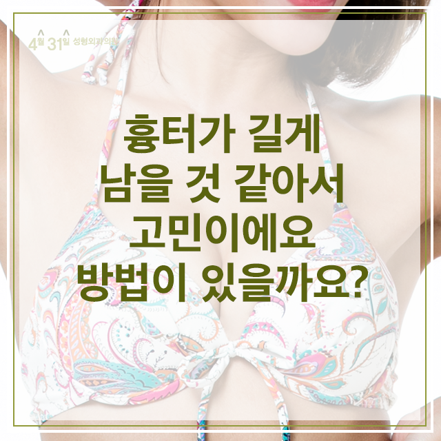 가슴축소수술 걱정말고 4월31일성형외과의원에서 관련 이미지 5