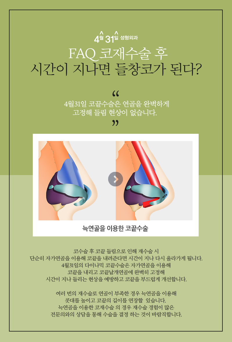 코재수술잘하는병원 4월31일성형외과의 만족감! 관련 이미지 4