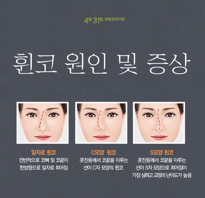 휜코수술잘하는곳 4월31일성형외과의원 입니다. 관련 이미지 2