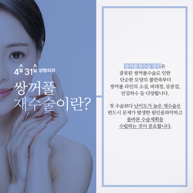 쌍꺼풀재수술후기 4월31일성형외과의 만족감! 관련 이미지 2
