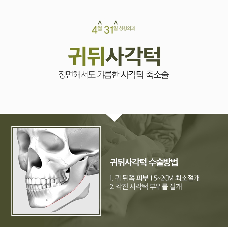 강남안면윤곽수술 4월31일성형외과에서 매끄럽게 관련 이미지 3