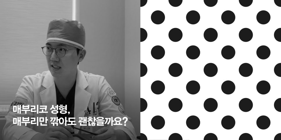 [April 31 Plastic Surgery] Hump Nose Surgery: Is It Okay to Just Shave Down the Hump? image 1