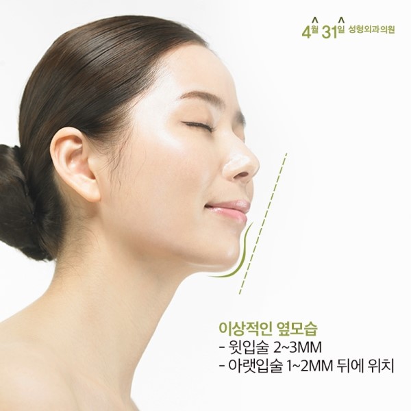 무턱수술비용 합리적 4월31일성형외과 관련 이미지 4