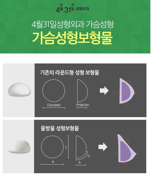 가슴확대수술가격을 알아보자! 4월31일성형외과에서! 관련 이미지 3
