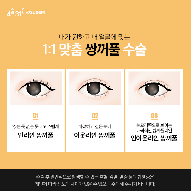 강남눈성형잘하는곳 4월31일성형외과에요 관련 이미지 3