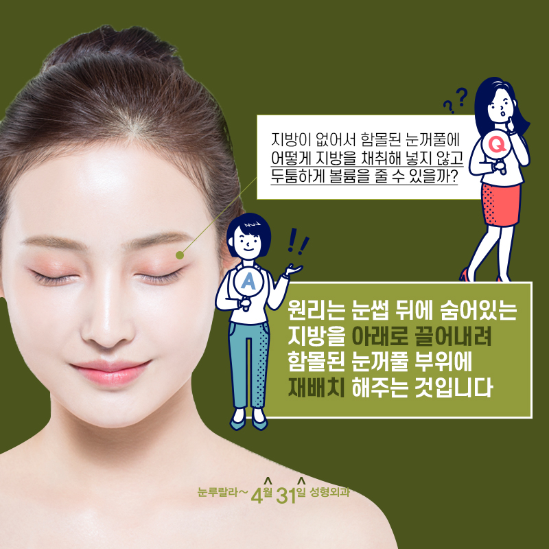 If You Want to Make Hollow Upper Eyelids Look More Alive image 4