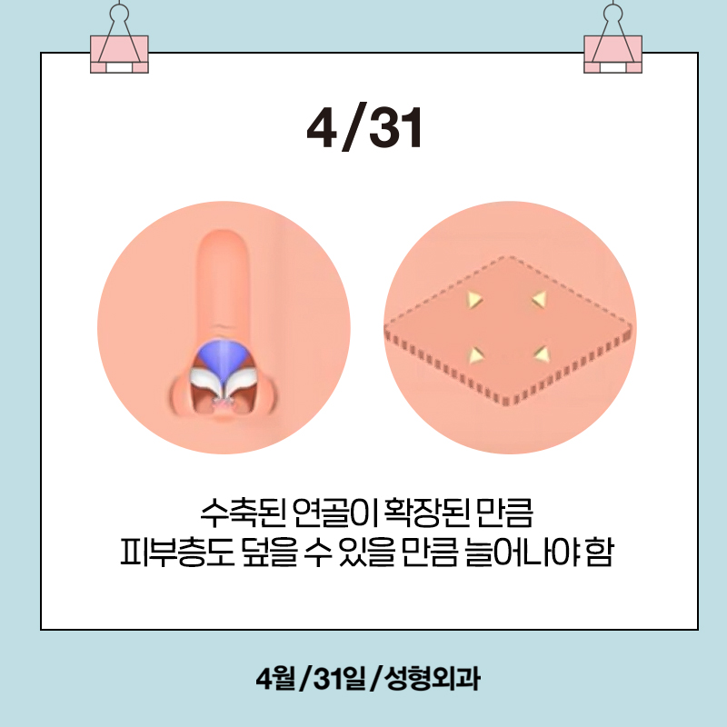 [Contracted Nose] Deep Analysis of the 5-Step Contracted Nose Correction Surgery Part 01_ Sufficient Dissection and Release image 4