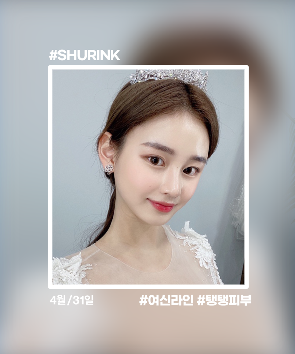 The perfect combo to get with Shurink — curious? Shurink V Pack image 2
