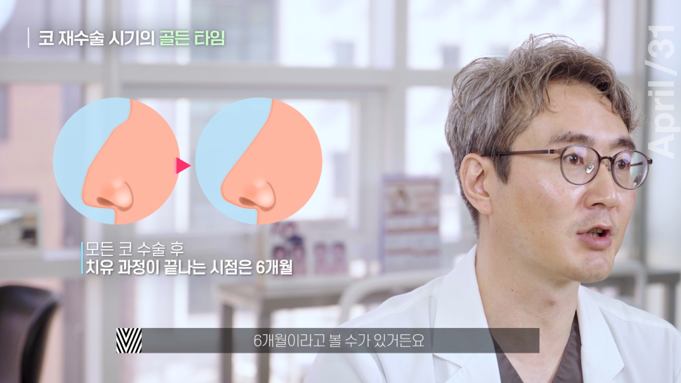 [Revision Rhinoplasty] What Is the Golden Time for Revision Rhinoplasty? image 9