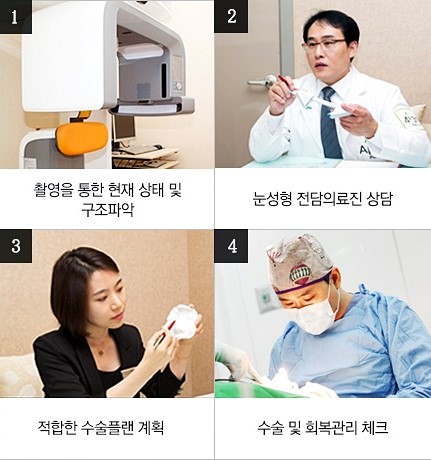 앞트임회복 빠르게 4월31일성형외과의원 관련 이미지 3