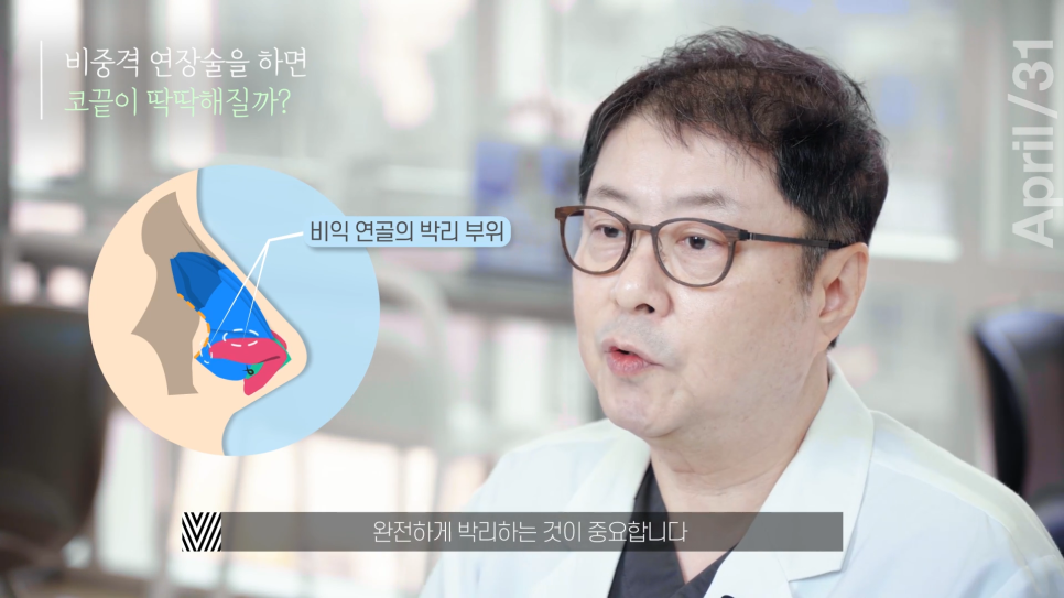 [Rhinoplasty] After Nose Surgery, the Shape Is Beautiful, but the Tip Feels Hard? image 7