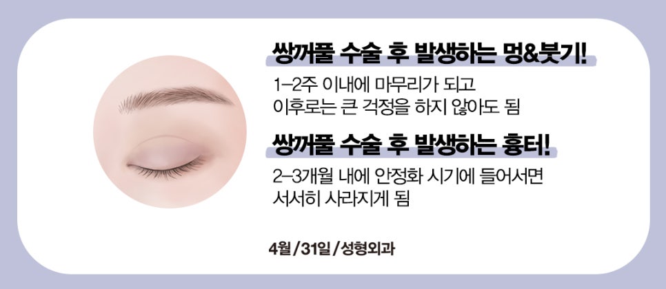 [Eye Surgery] Swelling and Scarring After Double Eyelid Surgery image 4