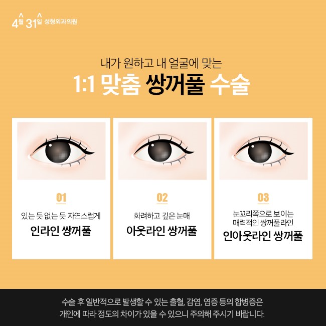 눈성형잘하는곳 4월31일성형외과 관련 이미지 3