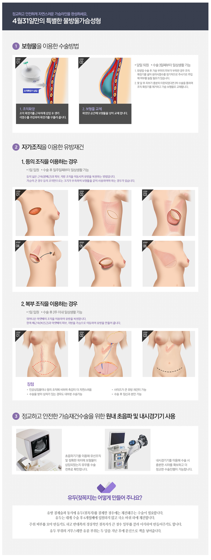 유방재건술 믿음 가는 4월31일성형외과 관련 이미지 3