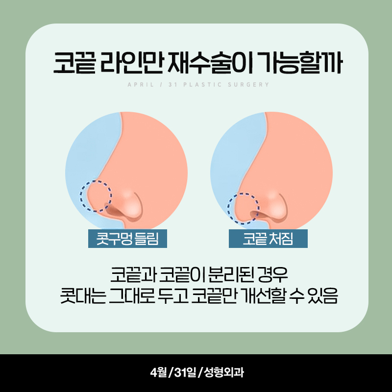 [Rhinoplasty] A Thorough Look at the 2024 Nose Trend! - An Analysis of Current Nose Trends image 6