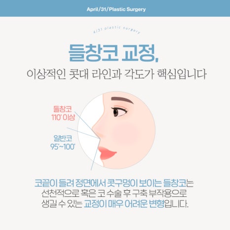 [코성형] 들창코,돼지코 고민이라면? 관련 이미지 3
