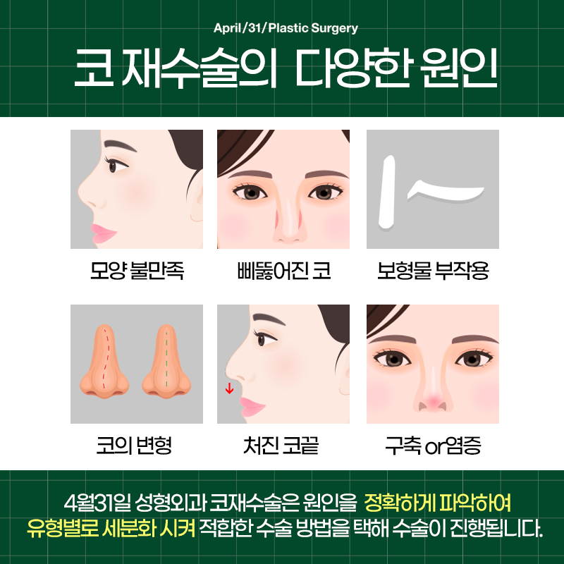 [Nose Revision Surgery] 4월31일 Plastic Surgery That Considers the Next 10 or 20 Years image 3