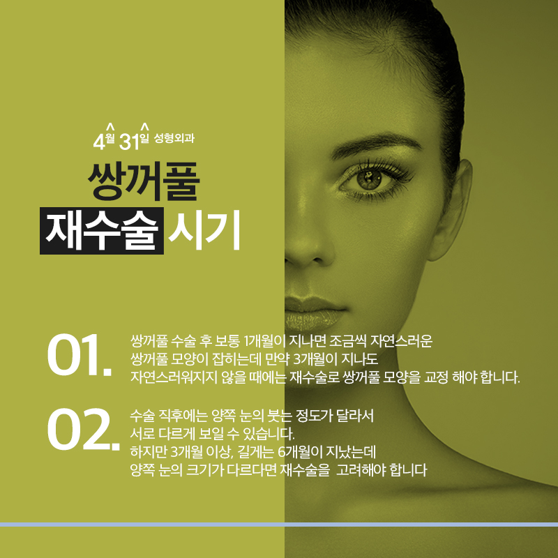 쌍꺼풀재수술가격 적당한곳이란 관련 이미지 4