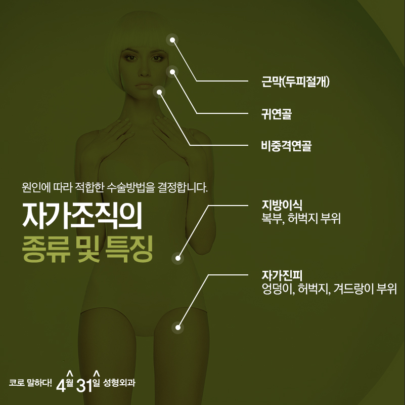 자가조직 코성형 방법 무엇이 있는지 궁금하다면? 관련 이미지 4