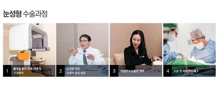 앞트임복원 4월31일성형외과에 맡기세요 관련 이미지 3