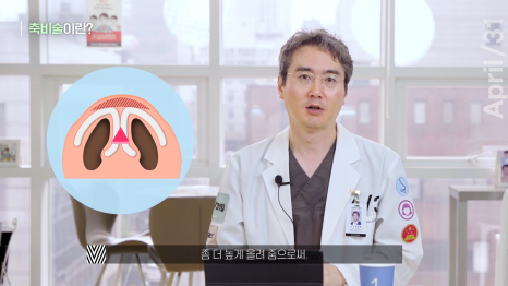 뭉툭한 코, 매부리코를 가지고 있다면 관련 이미지 5