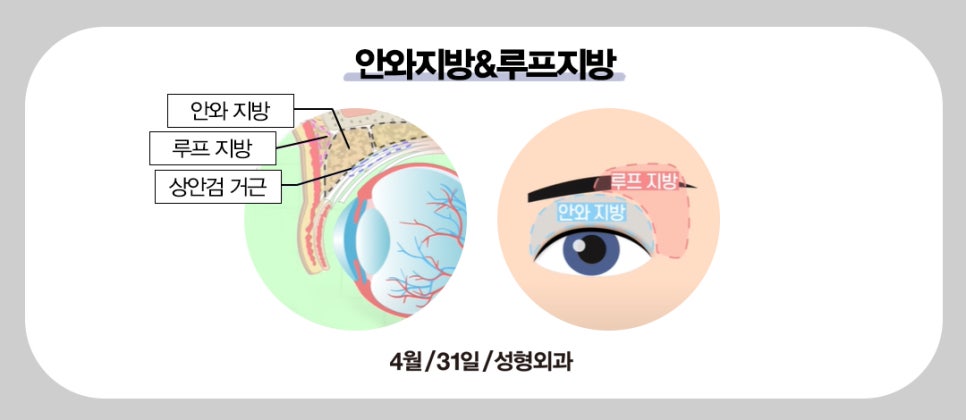 나이 들어보이는 꺼진눈 고민이라면? (feat.눈꺼풀 볼륨업) 관련 이미지 2
