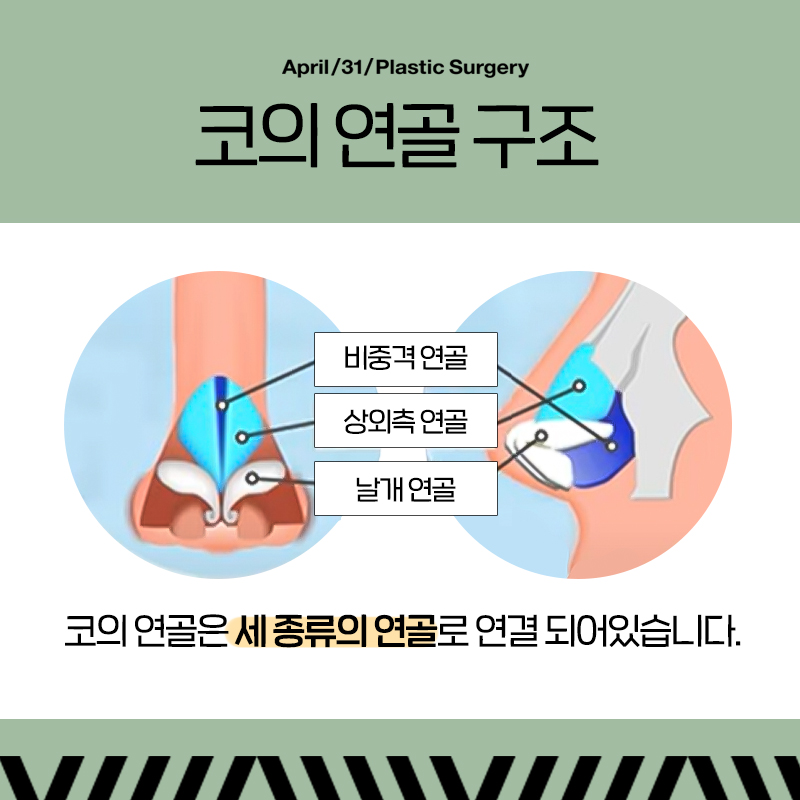 [Contracted Nose] Deep Analysis of the 5 Steps of Contracted Nose Correction Part 02_Separation of the Cartilage Structure and Relocation to the Correct Position image 2