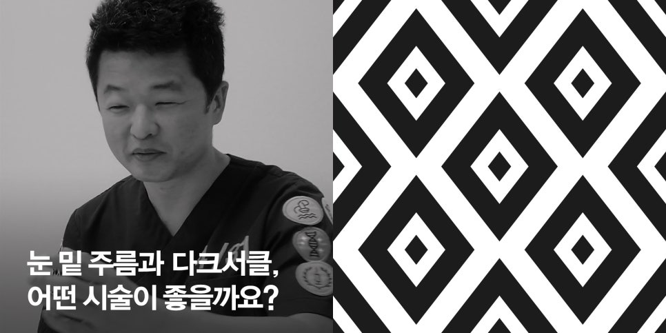 [Ultimate Lifting Proje] What Treatment Is Good for Under-Eye Wrinkles and Dark Circles? image 1