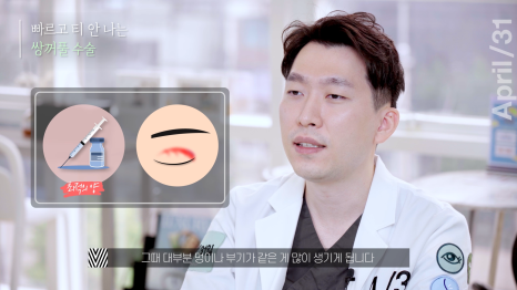 [Eye Surgery] Getting Double Eyelid Surgery Quickly and Discreetly for Vacation! image 4