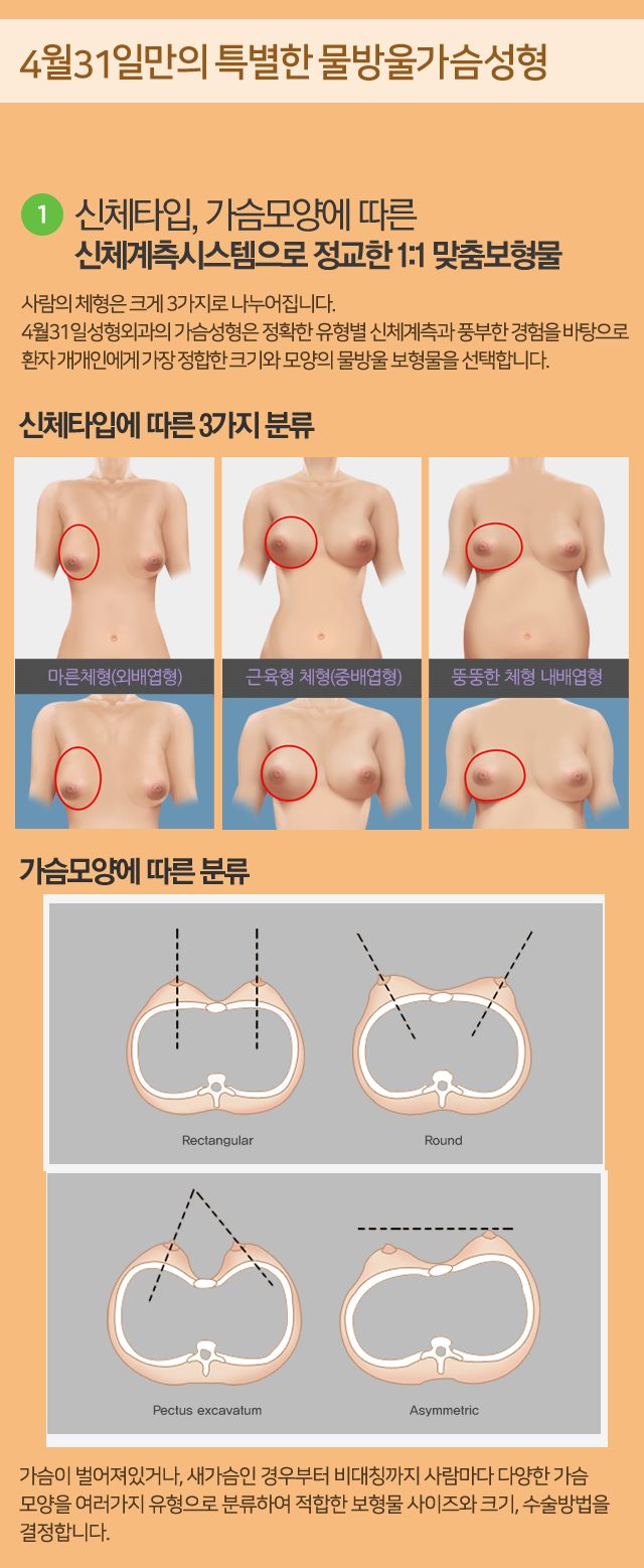 물방울가슴성형유명한곳 4월31일성형외과 관련 이미지 1