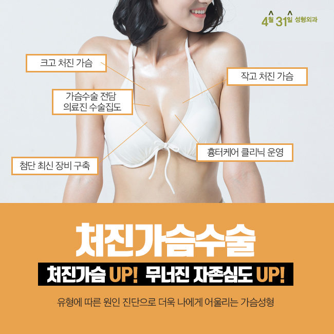 가슴수술유명한병원 4월31일성형외과에서 UP 관련 이미지 5