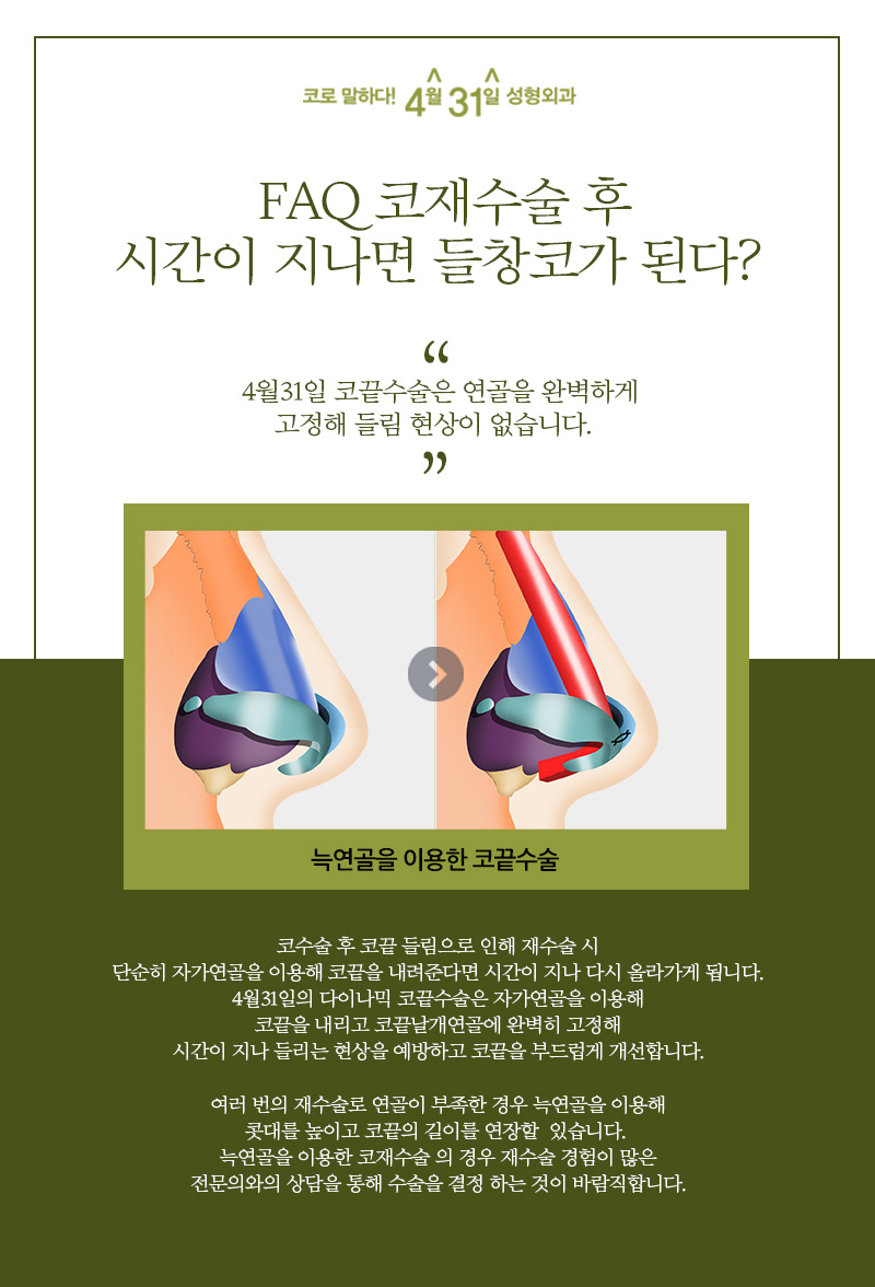 코재수술잘하는성형외과 4월31일성형외과 관련 이미지 3