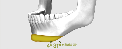 무턱수술후기 만족스러운 이유! 관련 이미지 4