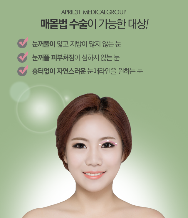 매몰법잘하는곳 4월31일성형외과와 상담하세요 관련 이미지 3