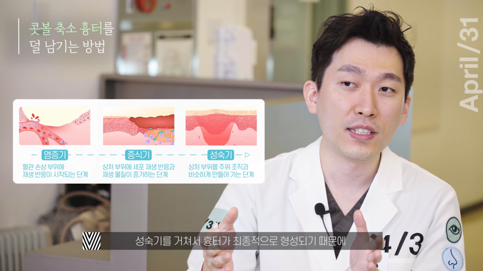 [Nose Surgery] Is It Possible to Reduce a Bulbous Nose with Alar Reduction? Yes or No? image 9