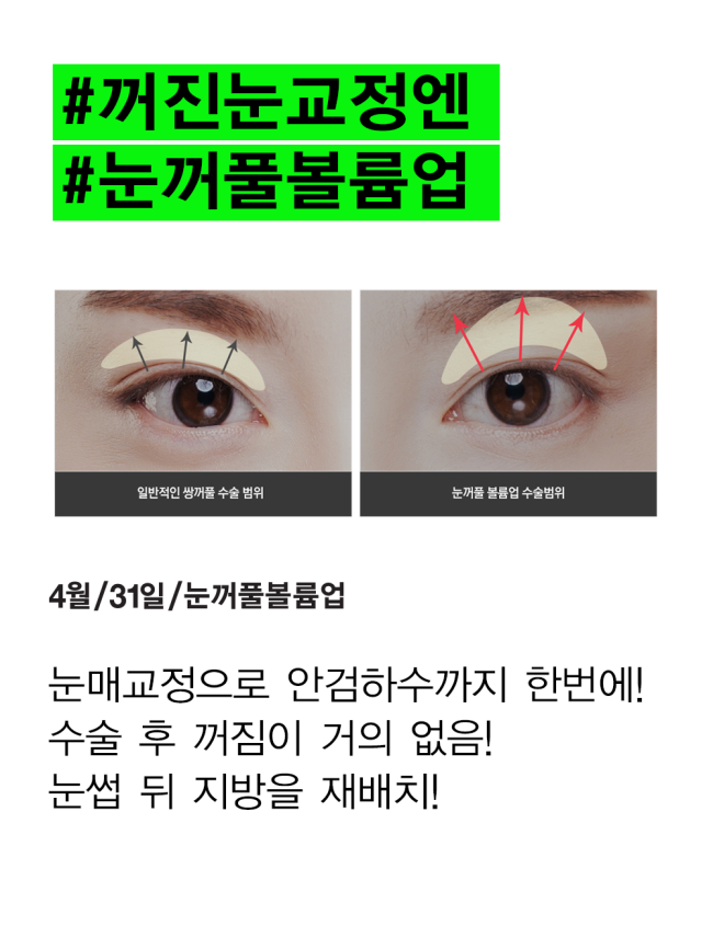 For Sunken Eyelids, Director Oh Won-seok’s Eyelid Volume Up ↑↑↑ image 4