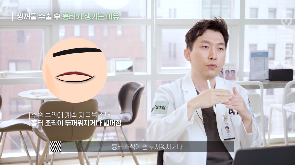 [Eye Plastic Surgery] The Dark and Light Sides of Eye Plastic Surgery - About Scars from Double Eyelid Surgery image 8