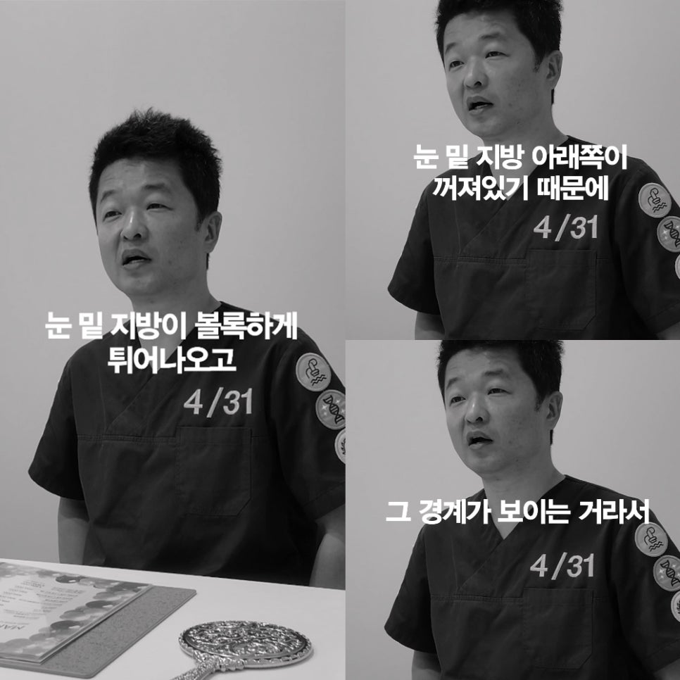 [Ultimate Lifting Proje] What Treatment Is Good for Under-Eye Wrinkles and Dark Circles? image 5