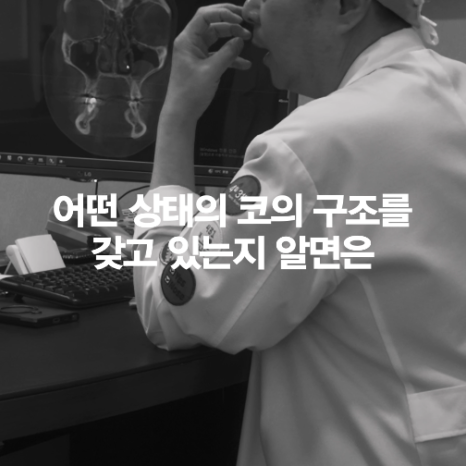 [4월31일성형외과] 코 수술 전 CT 꼭 찍어야 하나요? 관련 이미지 3