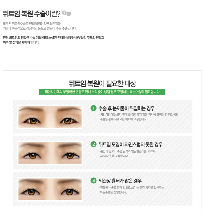 앞트임복원 4월31일성형외과에 맡기세요 관련 이미지 2