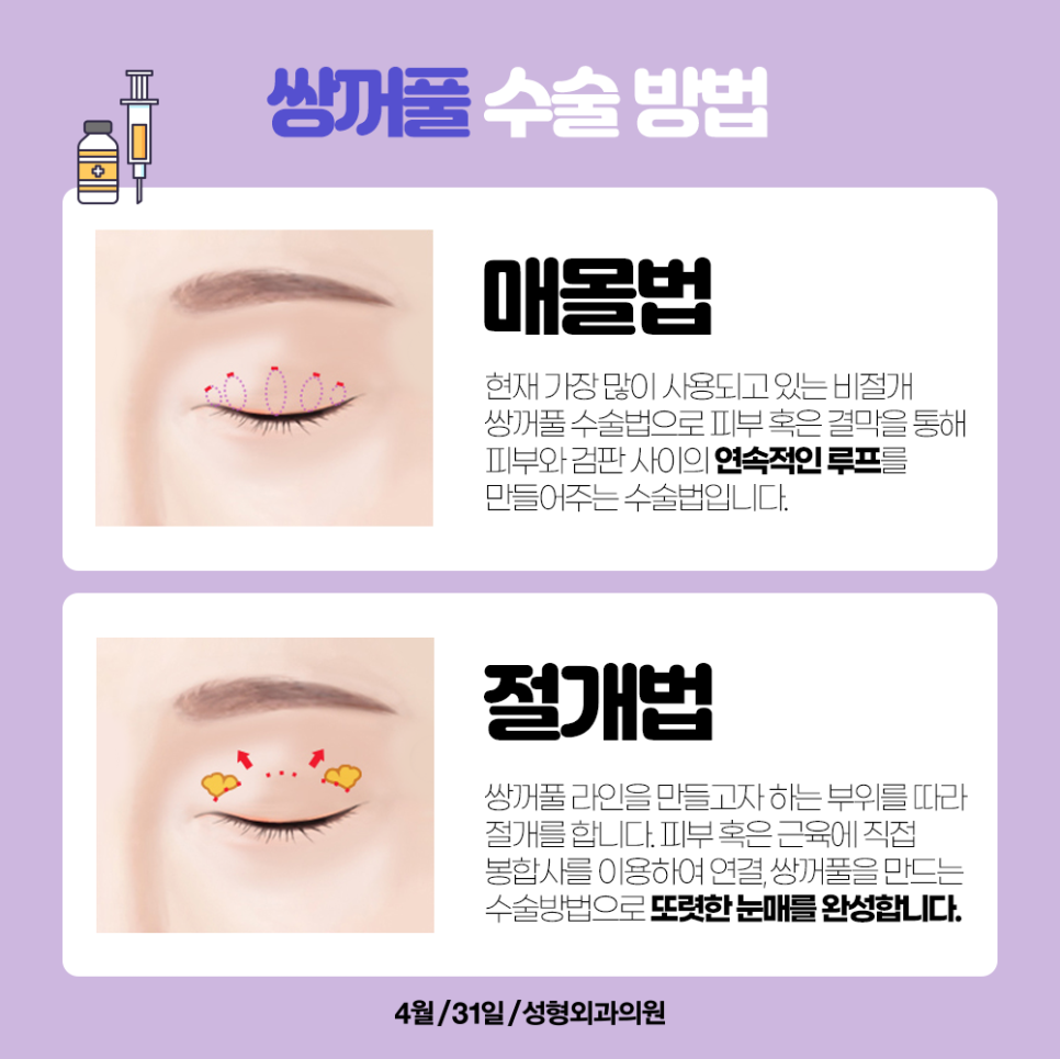4월31일이 쌍꺼풀수술유명한병원으로 소문난 이유!? 관련 이미지 3
