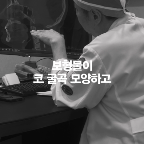 [4월31일성형외과] 코 수술 전 CT 꼭 찍어야 하나요? 관련 이미지 9