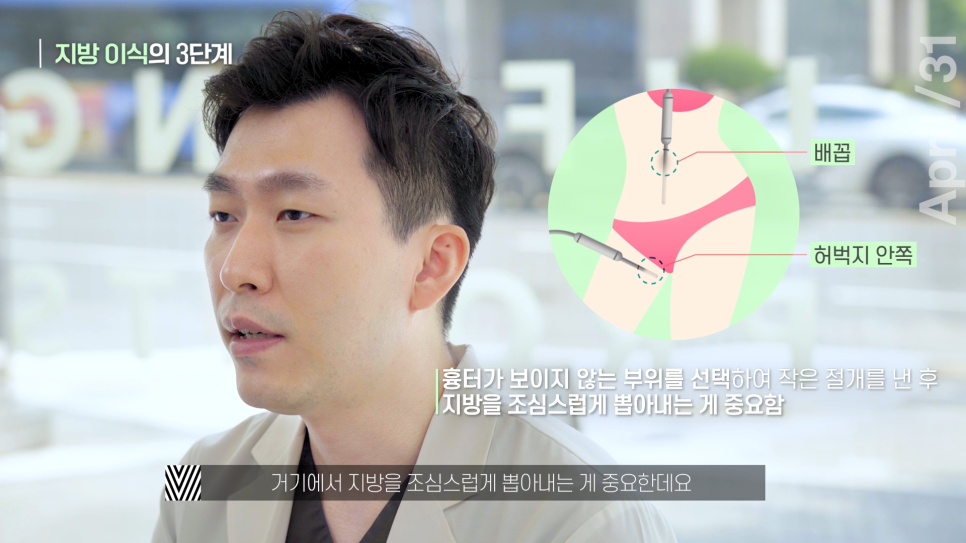 [안티에이징] 지방이식 그것이 알고싶다! 관련 이미지 7