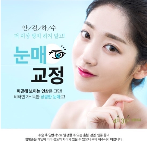 안검하수 눈매교정으로 또렷한 눈매로 거듭나다! 관련 이미지 1