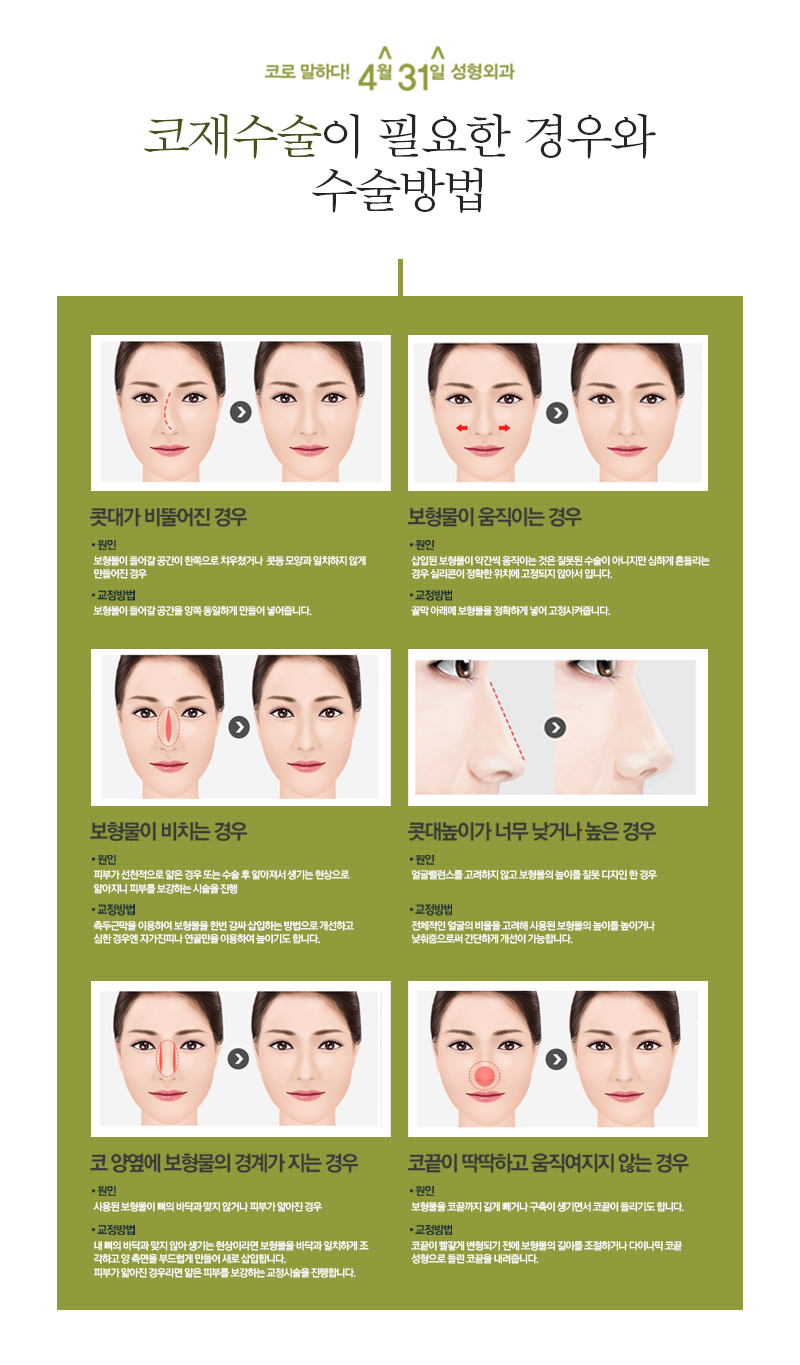If you’re 고민ing about where to go for a plastic surgery clinic that specializes in contracture nose revision surgery? image 5
