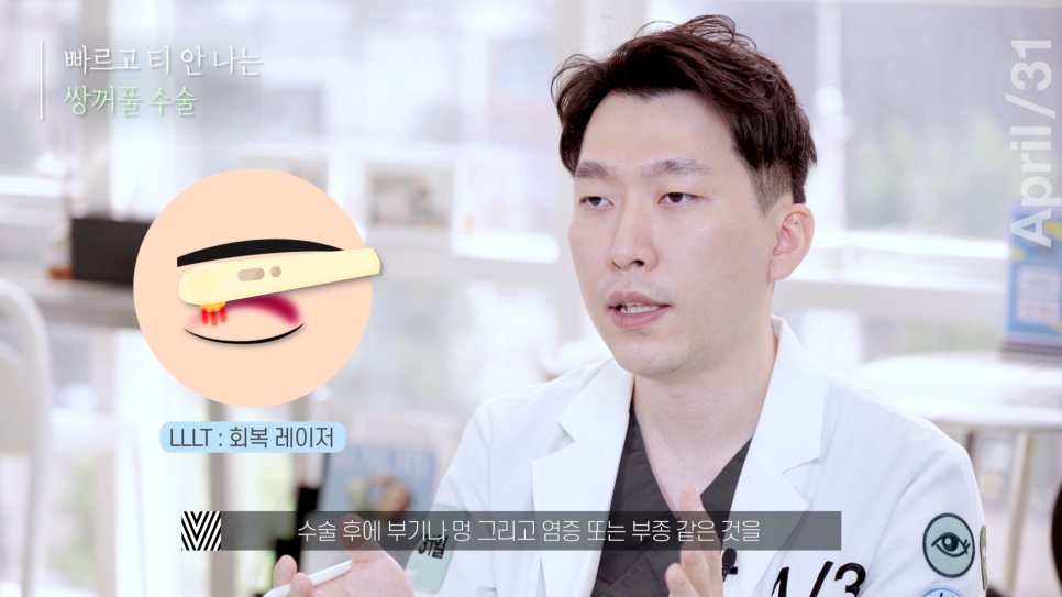 [Eye Surgery] Getting Double Eyelid Surgery Quickly and Discreetly for Vacation! image 8