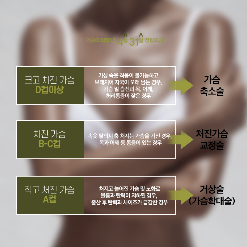 가슴축소수술 통증과 흉터가 걱정되었다면? 4월 31일 성형외과 관련 이미지 2