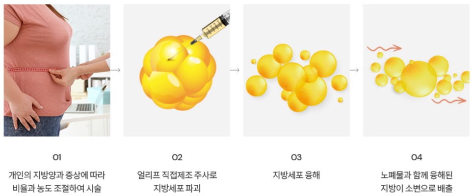 간단한 시술로 슬림탄탄 바디라인 완성!(바디레이저/바디보톡스/라인주사) 관련 이미지 5